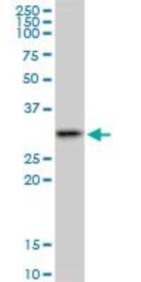 Western Blot: SMNDC1 Antibody [H00010285-B01P]