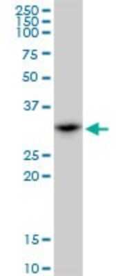 Western Blot: SMNDC1 Antibody [H00010285-B01P]