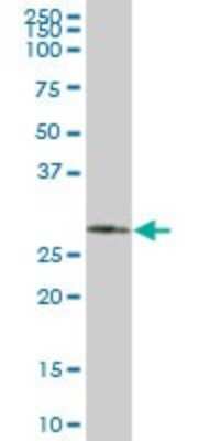 Western Blot: SMNDC1 Antibody [H00010285-B01P]