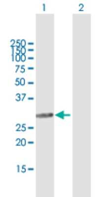 Western Blot: SMNDC1 Antibody [H00010285-B01P]