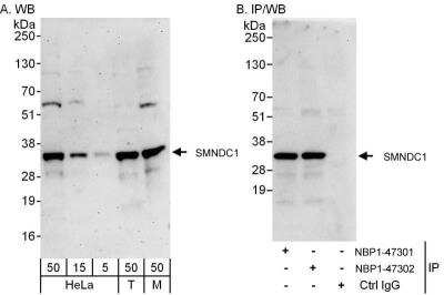 Western Blot: SMNDC1 Antibody [NBP1-47302]