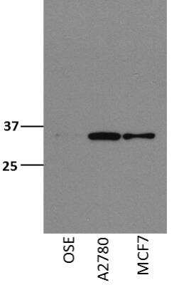 Western Blot: SMNDC1 Antibody [NBP1-47302]