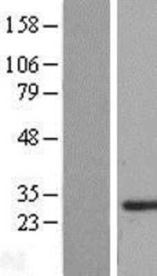 Western Blot: SMNDC1 Overexpression Lysate [NBL1-16245]