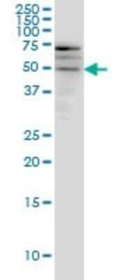 Western Blot: SMOC-1 Antibody (8F10) [H00064093-M03]