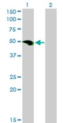 Western Blot: SMOC-1 Antibody (8F10) [H00064093-M03]