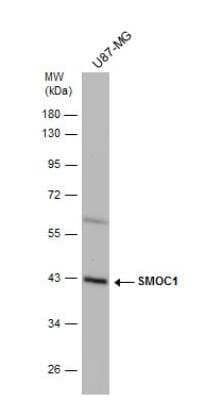 Western Blot: SMOC-1 Antibody [NBP2-15123]