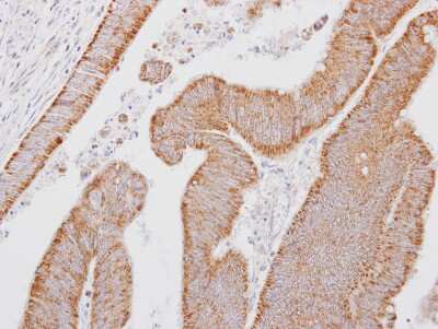 Immunohistochemistry-Paraffin: SMOC-1 Antibody [NBP2-15123]