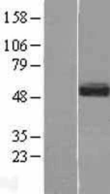 Western Blot: SMOC-1 Overexpression Lysate [NBL1-16246]