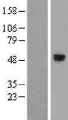 Western Blot: SMOC-1 Overexpression Lysate [NBL1-16247]