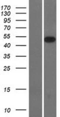 Western Blot: SMOC-2 Overexpression Lysate [NBL1-16248]