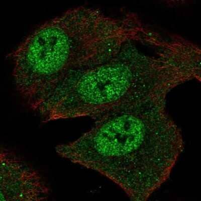 Immunocytochemistry/ Immunofluorescence: SMOX Antibody [NBP2-55775]