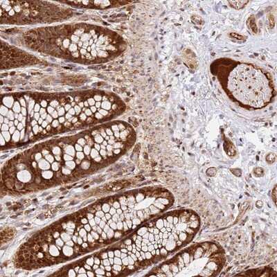 Immunohistochemistry-Paraffin: SMOX Antibody [NBP2-13356]