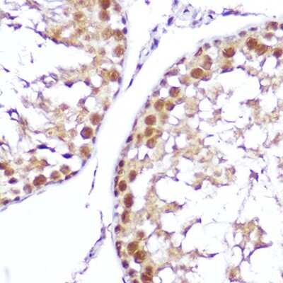 Immunohistochemistry-Paraffin: SMOX Antibody - Azide and BSA Free [NBP3-04509]