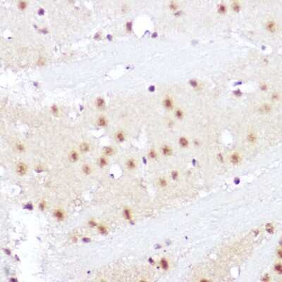 Immunohistochemistry-Paraffin: SMOX Antibody - Azide and BSA Free [NBP3-04509]