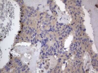 Immunohistochemistry: SMPD1 Antibody (OTI3H7) [NBP2-45889]