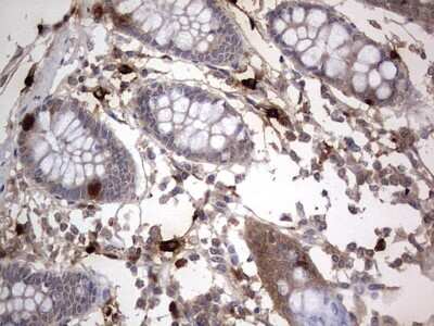 Immunohistochemistry: SMPD1 Antibody (OTI3H7) [NBP2-45889]