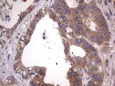 Immunohistochemistry: SMPD1 Antibody (OTI3H7) [NBP2-45889]
