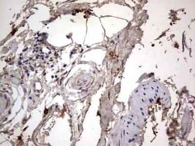 Immunohistochemistry: SMPD1 Antibody (OTI3H7) [NBP2-45889]