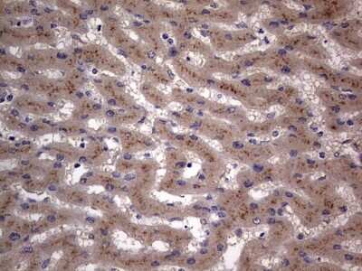 Immunohistochemistry: SMPD1 Antibody (OTI3H7) [NBP2-45889]