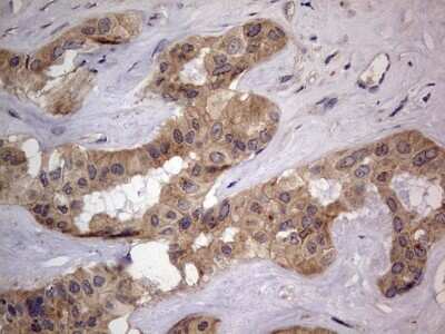 Immunohistochemistry: SMPD1 Antibody (OTI3H7) [NBP2-45889]