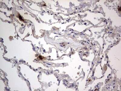 Immunohistochemistry: SMPD1 Antibody (OTI3H7) [NBP2-45889]