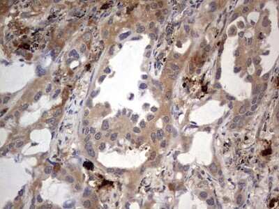Immunohistochemistry: SMPD1 Antibody (OTI3H7) [NBP2-45889]