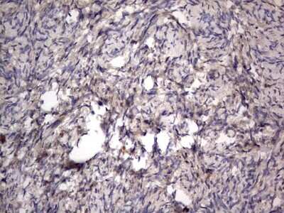 Immunohistochemistry: SMPD1 Antibody (OTI3H7) [NBP2-45889]