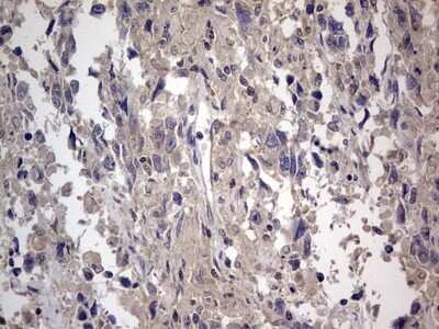 Immunohistochemistry: SMPD1 Antibody (OTI3H7) [NBP2-45889]