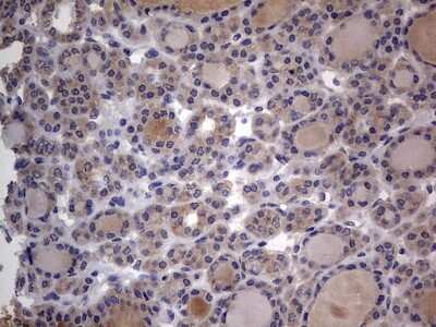 Immunohistochemistry: SMPD1 Antibody (OTI3H7) [NBP2-45889]