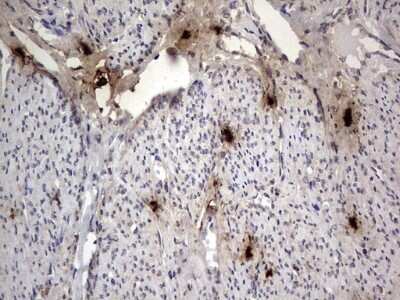 Immunohistochemistry: SMPD1 Antibody (OTI3H7) [NBP2-45889]