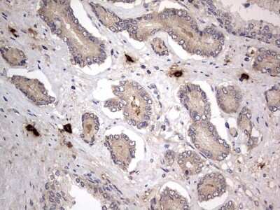 Immunohistochemistry: SMPD1 Antibody (OTI3H7) [NBP2-45889]
