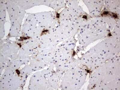 Immunohistochemistry: SMPD1 Antibody (OTI3H7) [NBP2-45889]