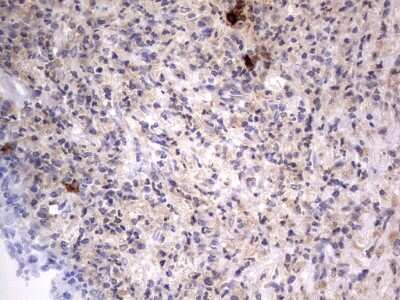 Immunohistochemistry: SMPD1 Antibody (OTI3H7) [NBP2-45889]