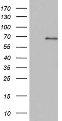 Western Blot: SMPD1 Antibody (OTI3H7) [NBP2-45889]