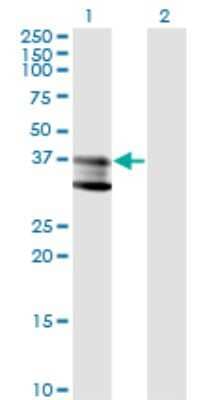 Western Blot: SMPD1 Antibody (4H2) [H00006609-M01]