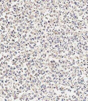 Immunohistochemistry-Paraffin: SMPD1 Antibody [NBP2-22365]