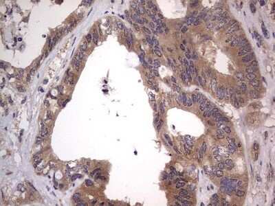 Immunohistochemistry: SMPD1 Antibody (OTI3H7) - Azide and BSA Free [NBP2-74240]