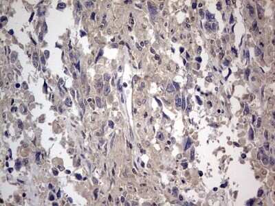 Immunohistochemistry: SMPD1 Antibody (OTI3H7) - Azide and BSA Free [NBP2-74240]