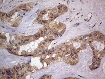 Immunohistochemistry: SMPD1 Antibody (OTI3H7) - Azide and BSA Free [NBP2-74240]