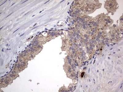 Immunohistochemistry: SMPD1 Antibody (OTI3H7) - Azide and BSA Free [NBP2-74240]