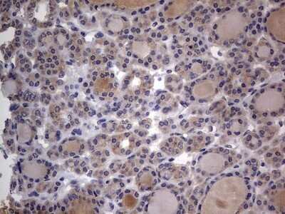 Immunohistochemistry: SMPD1 Antibody (OTI3H7) - Azide and BSA Free [NBP2-74240]