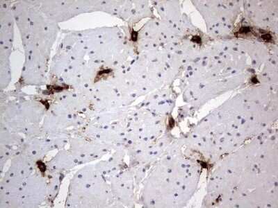 Immunohistochemistry: SMPD1 Antibody (OTI3H7) - Azide and BSA Free [NBP2-74240]