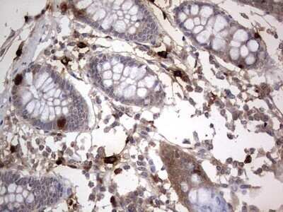 Immunohistochemistry: SMPD1 Antibody (OTI3H7) - Azide and BSA Free [NBP2-74240]