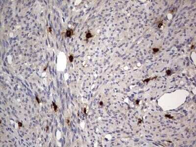 Immunohistochemistry: SMPD1 Antibody (OTI3H7) - Azide and BSA Free [NBP2-74240]