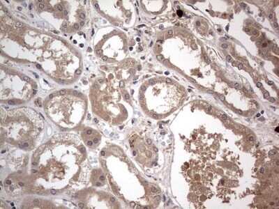 Immunohistochemistry: SMPD1 Antibody (OTI3H7) - Azide and BSA Free [NBP2-74240]