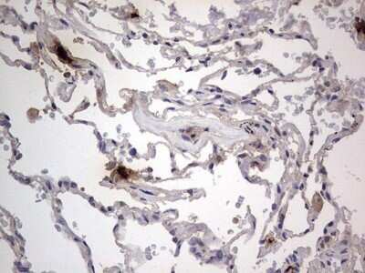 Immunohistochemistry: SMPD1 Antibody (OTI3H7) - Azide and BSA Free [NBP2-74240]