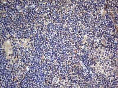 Immunohistochemistry: SMPD1 Antibody (OTI3H7) - Azide and BSA Free [NBP2-74240]