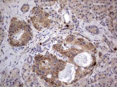 Immunohistochemistry: SMPD1 Antibody (OTI3H7) - Azide and BSA Free [NBP2-74240]