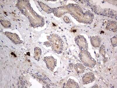 Immunohistochemistry: SMPD1 Antibody (OTI3H7) - Azide and BSA Free [NBP2-74240]