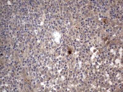 Immunohistochemistry: SMPD1 Antibody (OTI3H7) - Azide and BSA Free [NBP2-74240]
